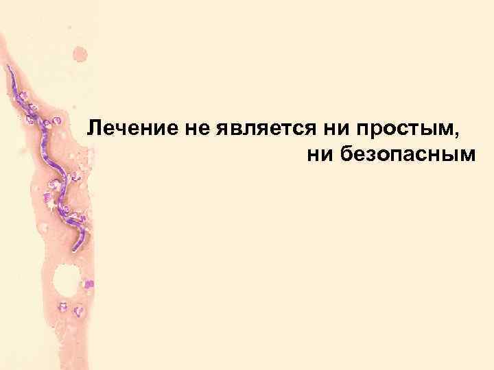 Лечение не является ни простым, ни безопасным 