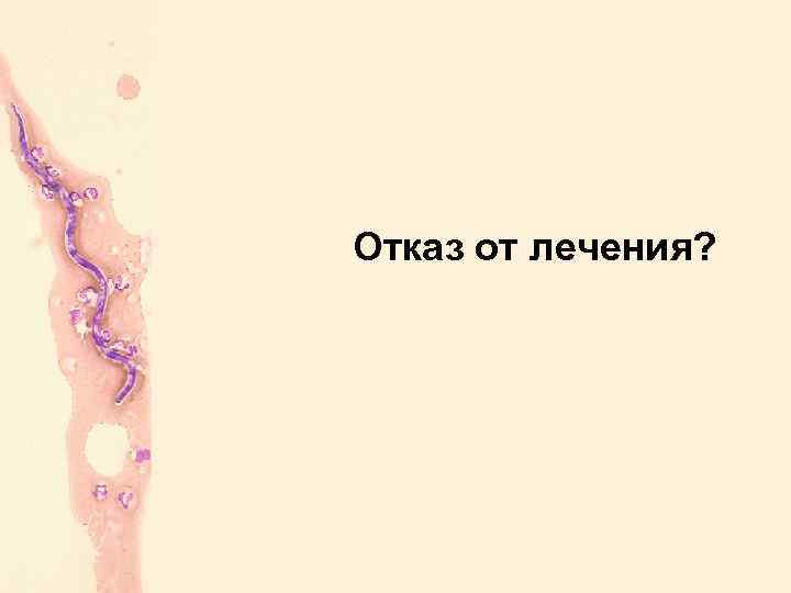 Отказ от лечения? 