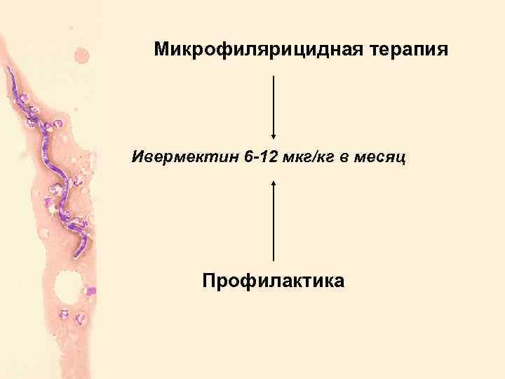 Микрофилярицидная терапия Ивермектин 6 -12 мкг/кг в месяц Профилактика 