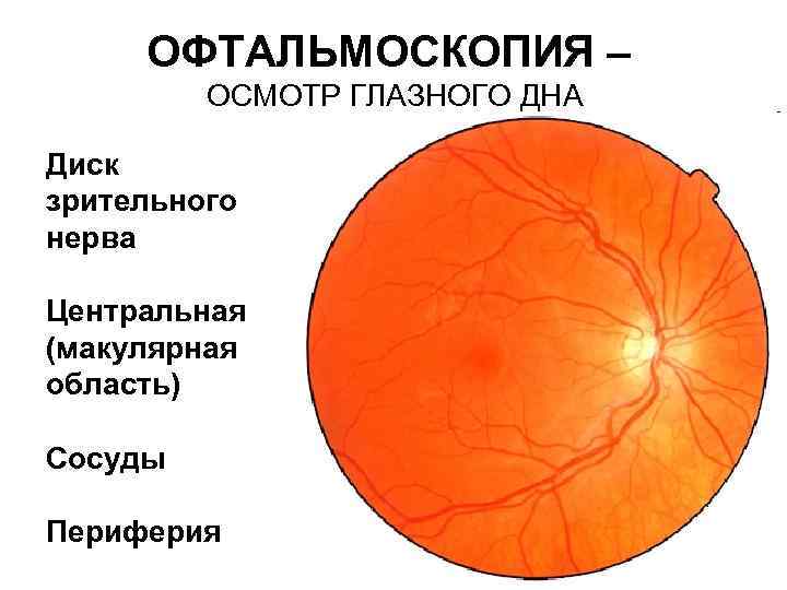 ОФТАЛЬМОСКОПИЯ – ОСМОТР ГЛАЗНОГО ДНА Диск зрительного нерва Центральная (макулярная область) Сосуды Периферия 