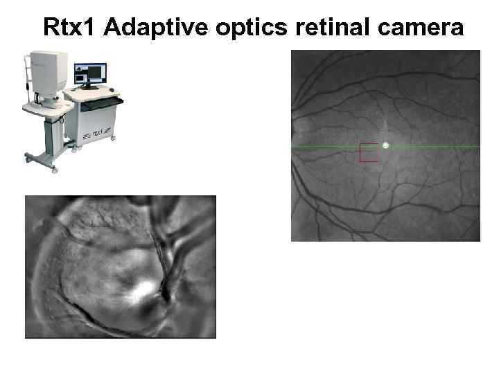 Rtx 1 Adaptive optics retinal camera 