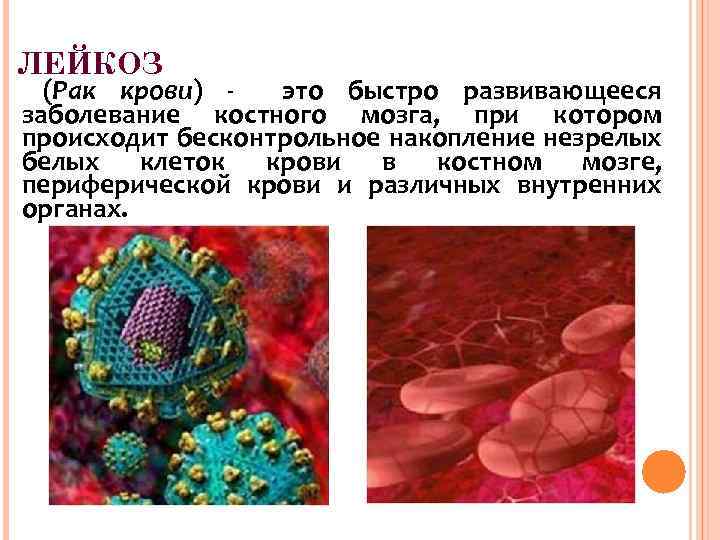 ЛЕЙКОЗ (Рак крови) это быстро развивающееся заболевание костного мозга, при котором происходит бесконтрольное накопление