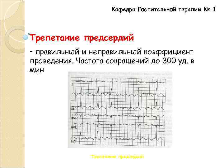 Кафедра Госпитальной терапии № 1 Трепетание предсердий – правильный и неправильный коэффициент проведения. Частота