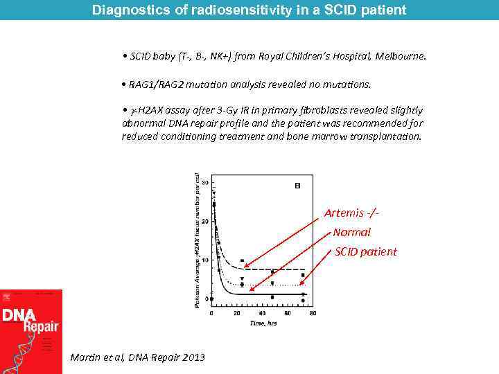 Diagnostics of radiosensitivity in a SCID patient • SCID baby (T-, B-, NK+) from