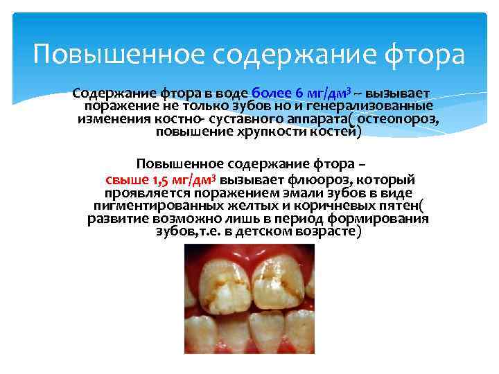 Повышенное содержание фтора Содержание фтора в воде более 6 мг/дм 3 -- вызывает поражение