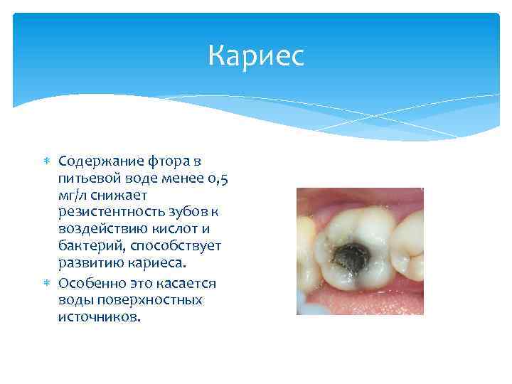 Кариес Содержание фтора в питьевой воде менее 0, 5 мг/л снижает резистентность зубов к