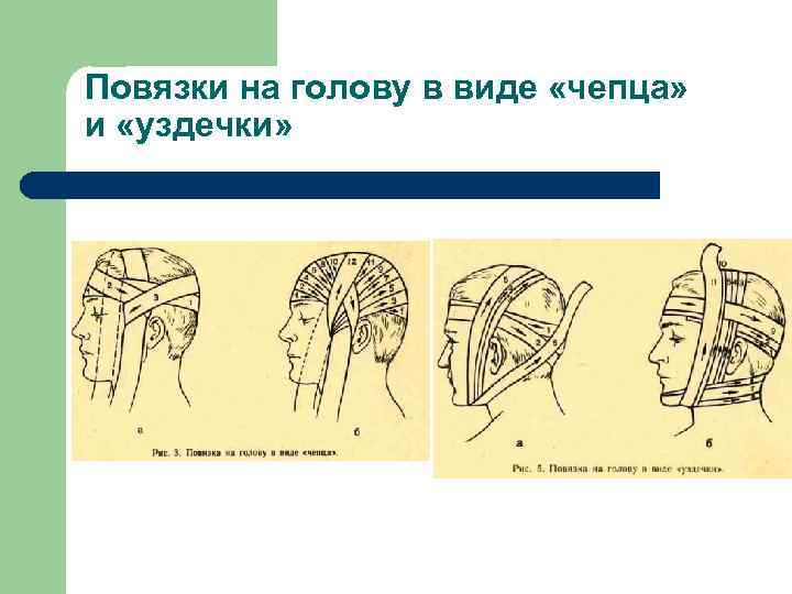 Повязки на голову в виде «чепца» и «уздечки» 