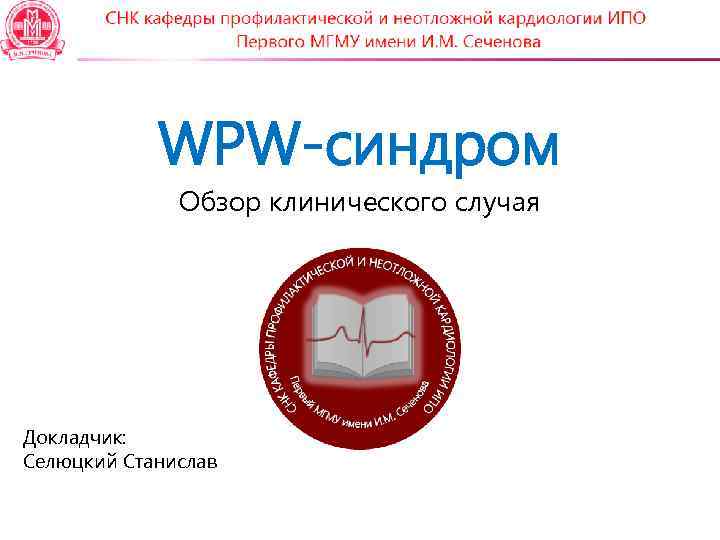 WPW-синдром Обзор клинического случая Докладчик: Селюцкий Станислав 