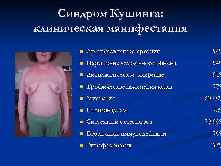 Синдром Кушинга: клиническая манифестация n Артериальная гипертония 94% n Нарушение углеводного обмена 94% n