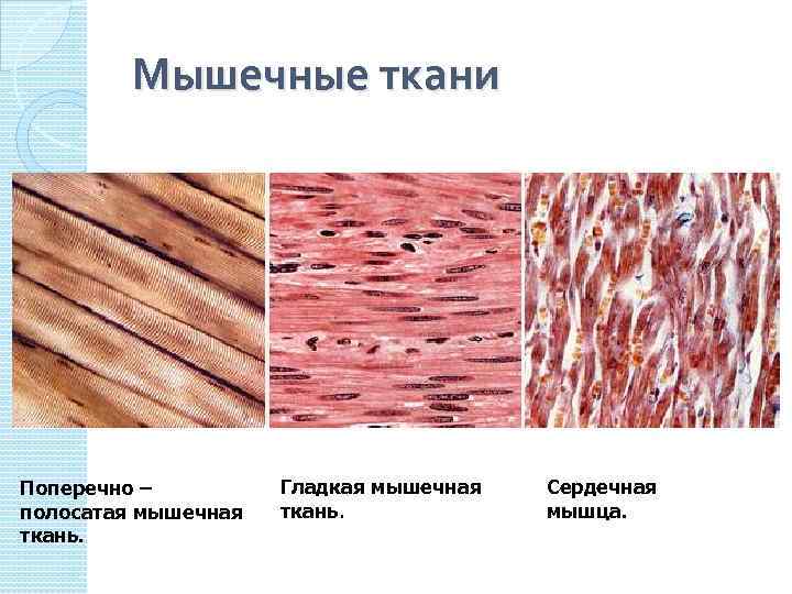 Изображения скелетной поперечнополосатой мышечной ткани