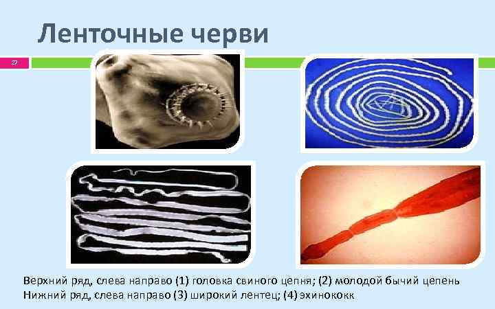 Ленточные черви 27 Верхний ряд, слева направо (1) головка свиного цепня; (2) молодой бычий