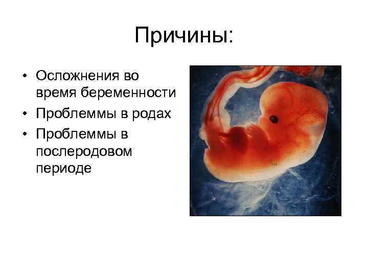 Причины: • Осложнения во время беременности • Проблеммы в родах • Проблеммы в послеродовом
