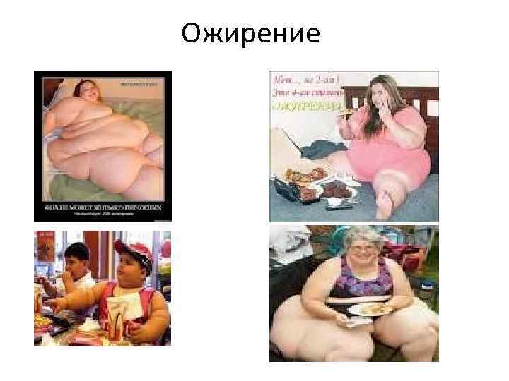 Ожирение 