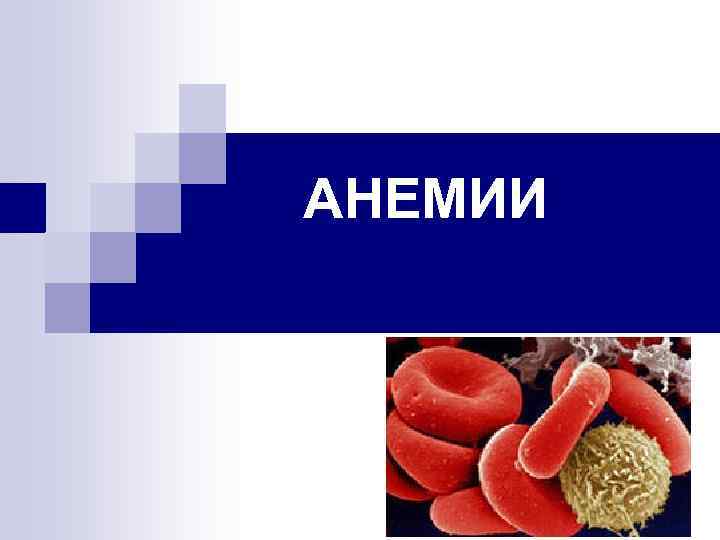 АНЕМИИ 