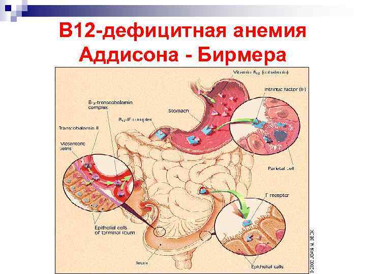 Болезнь аддисона картинки