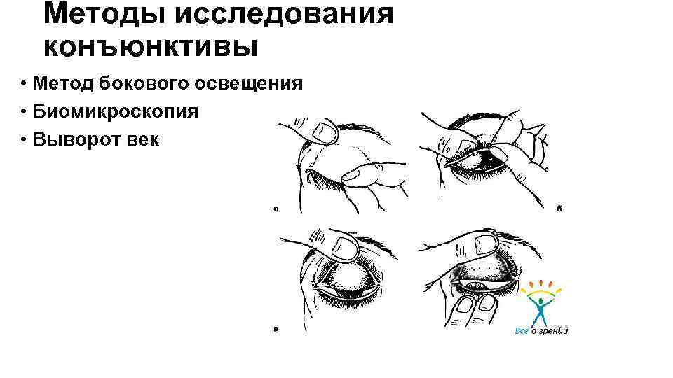 Исследование методом бокового освещения