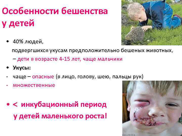 Особенности бешенства у детей • 40% людей, подвергшихся укусам предположительно бешеных животных, – дети