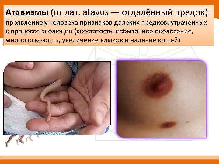 Атавизмы (от лат. atavus — отдалённый предок) проявление у человека признаков далеких предков, утраченных