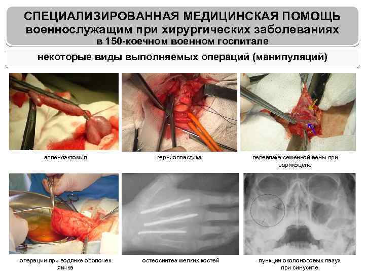 СПЕЦИАЛИЗИРОВАННАЯ МЕДИЦИНСКАЯ ПОМОЩЬ военнослужащим при хирургических заболеваниях в 150 -коечном военном госпитале некоторые виды