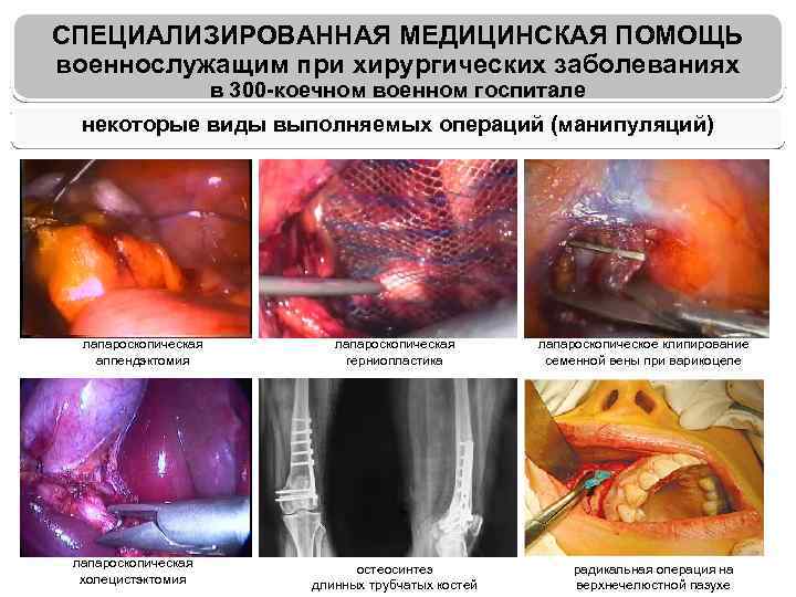 СПЕЦИАЛИЗИРОВАННАЯ МЕДИЦИНСКАЯ ПОМОЩЬ военнослужащим при хирургических заболеваниях в 300 -коечном военном госпитале некоторые виды