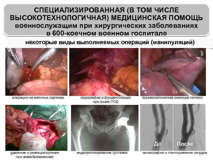 СПЕЦИАЛИЗИРОВАННАЯ (В ТОМ ЧИСЛЕ ВЫСОКОТЕХНОЛОГИЧНАЯ) МЕДИЦИНСКАЯ ПОМОЩЬ военнослужащим при хирургических заболеваниях в 600 -коечном