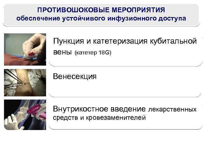 ПРОТИВОШОКОВЫЕ МЕРОПРИЯТИЯ обеспечение устойчивого инфузионного доступа Пункция и катетеризация кубитальной вены (катетер 18 G)
