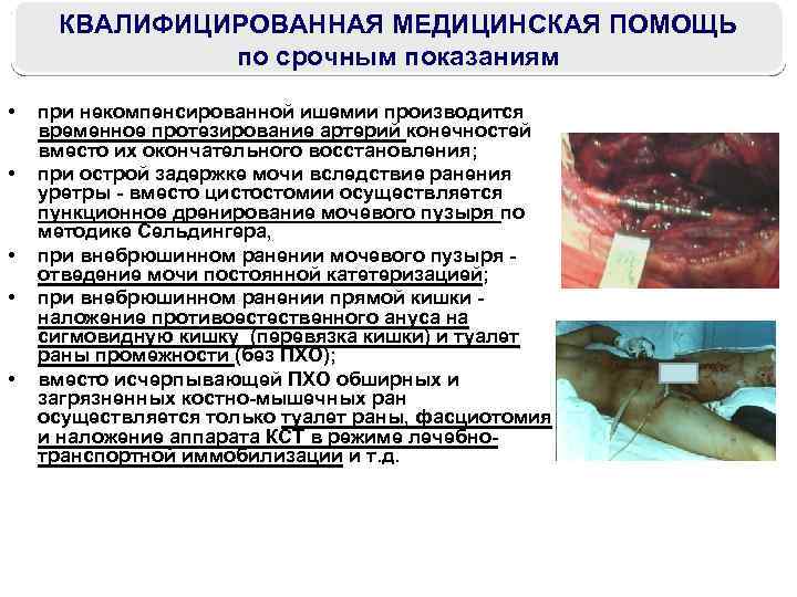 КВАЛИФИЦИРОВАННАЯ МЕДИЦИНСКАЯ ПОМОЩЬ по срочным показаниям • • • при некомпенсированной ишемии производится временное