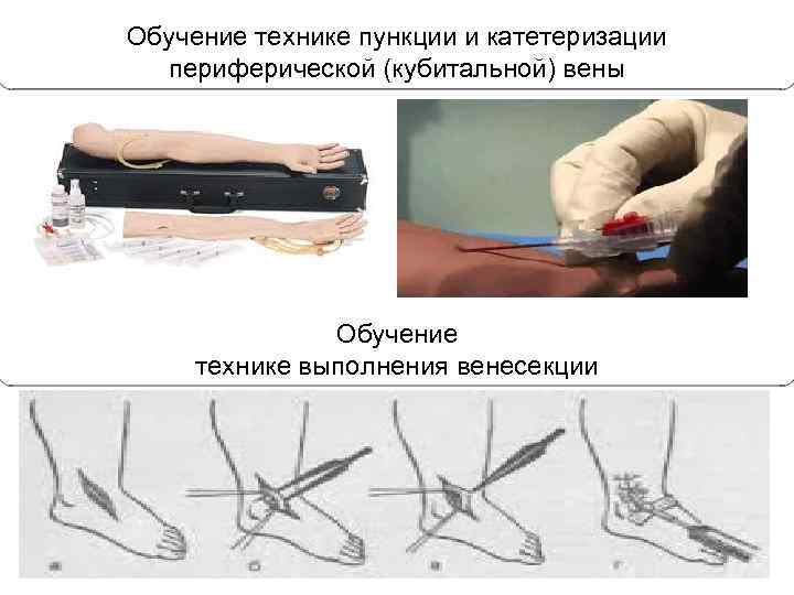 Обучение технике пункции и катетеризации периферической (кубитальной) вены Обучение технике выполнения венесекции 