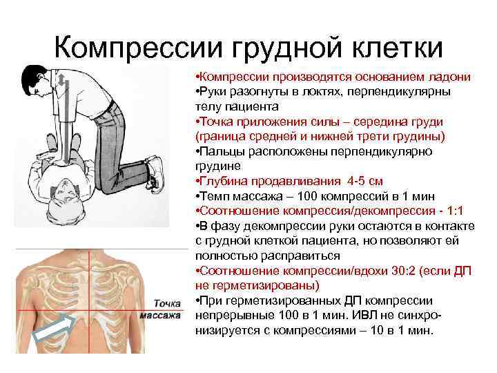 Закон фон лемана о компрессии