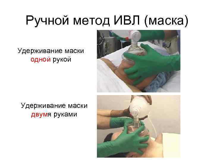 Ручной метод ИВЛ (маска) Удерживание маски одной рукой Удерживание маски двумя руками 