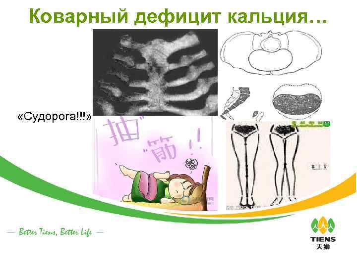 Коварный дефицит кальция… «Судорога!!!» 