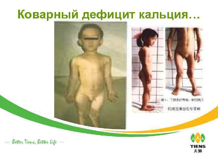 Коварный дефицит кальция… 