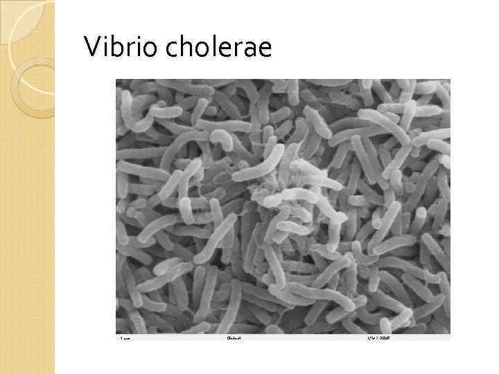 Vibrio cholerae 