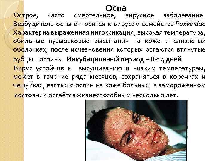 Оспа Острое, часто смертельное, вирусное заболевание. Возбудитель оспы относится к вирусам семейства Poxviridae Характерна