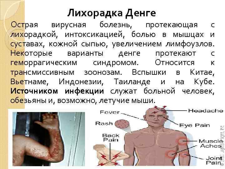 Лихорадка Денге Острая вирусная болезнь, протекающая с лихорадкой, интоксикацией, болью в мышцах и суставах,