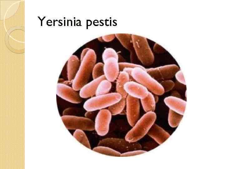Yersinia pestis 