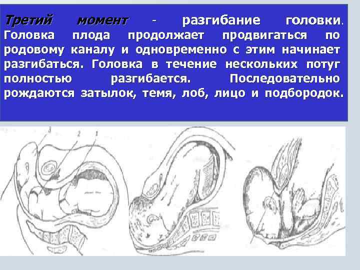 Третий момент - разгибание головки. Головка плода продолжает продвигаться по родовому каналу и одновременно