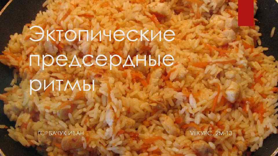 Эктопические предсердные ритмы ГОРБАЧУК ИВАН VI КУРС, 2 М-13 