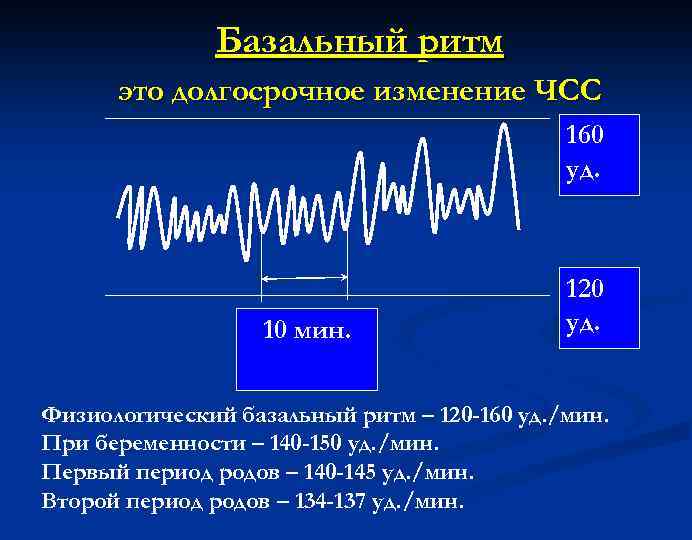 Базальный ритм это долгосрочное изменение ЧСС 160 уд. 10 мин. 120 уд. Физиологический базальный