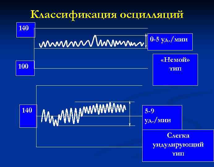 Классификация осцилляций 140 0 -5 уд. /мин 100 140 «Немой» тип 5 -9 уд.