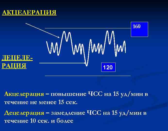 АКЦЕЛЕРАЦИЯ 160 ДЕЦЕЛЕРАЦИЯ 120 Акцелерация – повышение ЧСС на 15 уд/мин в течение не