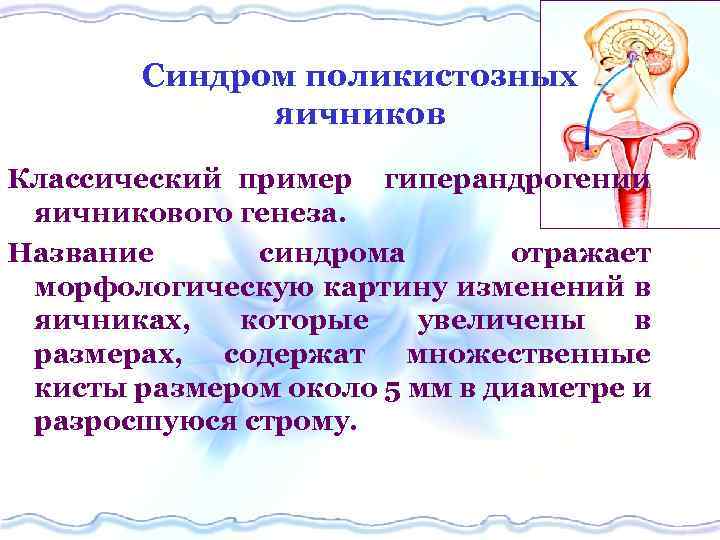 Синдром поликистозных яичников Классический пример гиперандрогении яичникового генеза. Название синдрома отражает морфологическую картину изменений