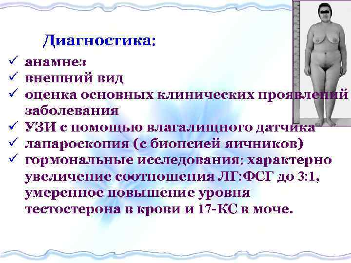 Диагностика ü анамнез ü внешний вид ü оценка основных клинических проявлений заболевания ü УЗИ