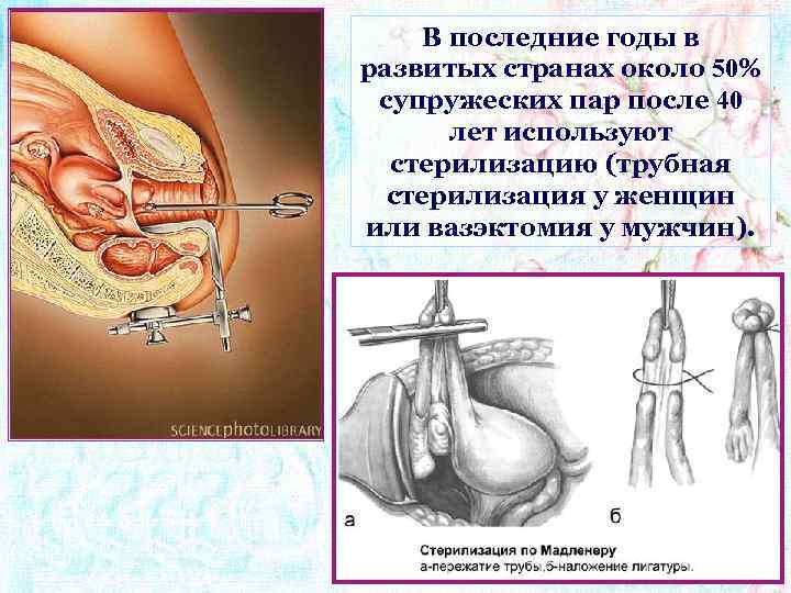 В последние годы в развитых странах около 50% супружеских пар после 40 лет используют