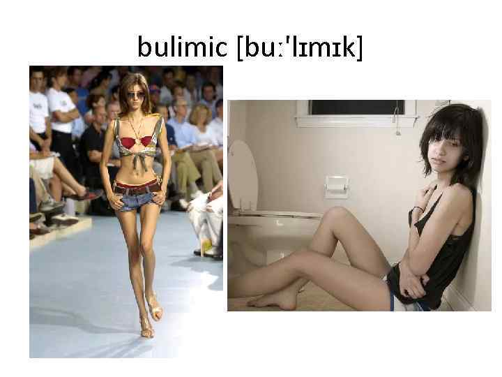 bulimic [buː'lɪmɪk] 