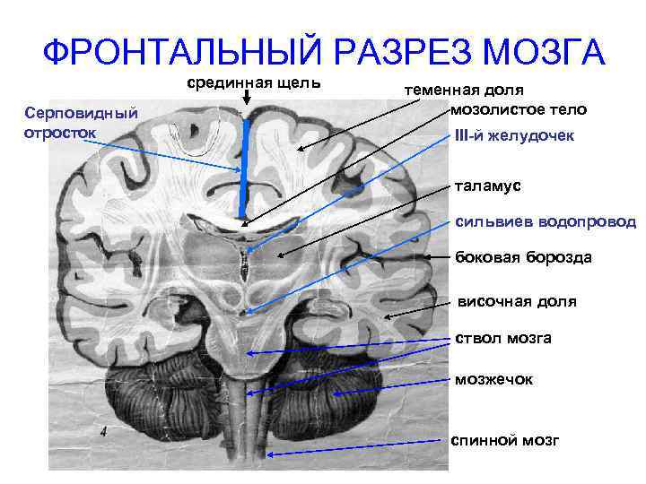 ФРОНТАЛЬНЫЙ РАЗРЕЗ МОЗГА срединная щель Серповидный отросток теменная доля мозолистое тело III-й желудочек таламус