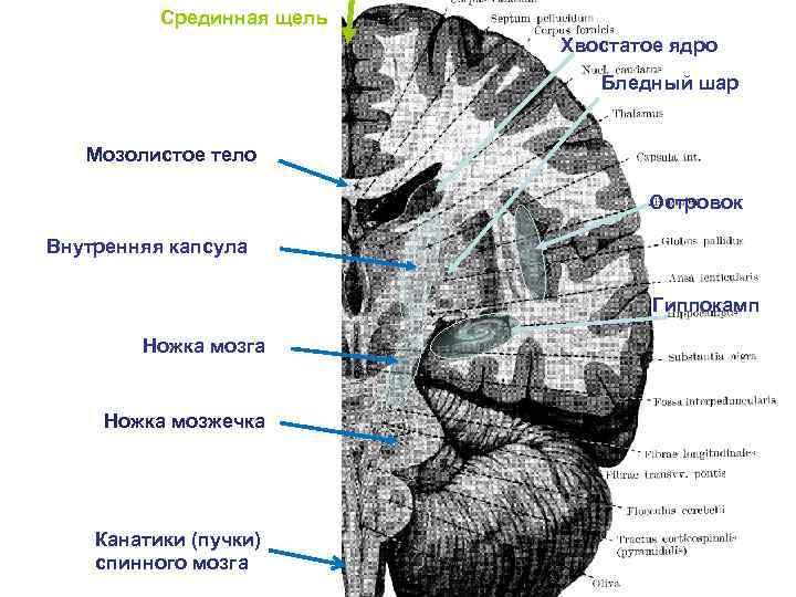 Мозолистое тело какая ткань