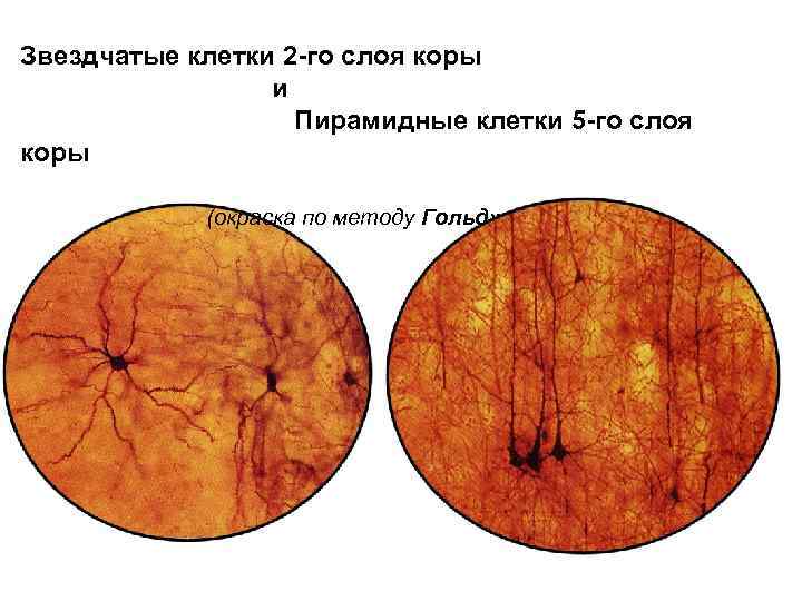 Звездчатые клетки 2 -го слоя коры и Пирамидные клетки 5 -го слоя коры (окраска