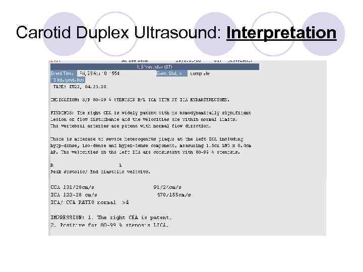 Carotid Duplex Ultrasound: Interpretation 