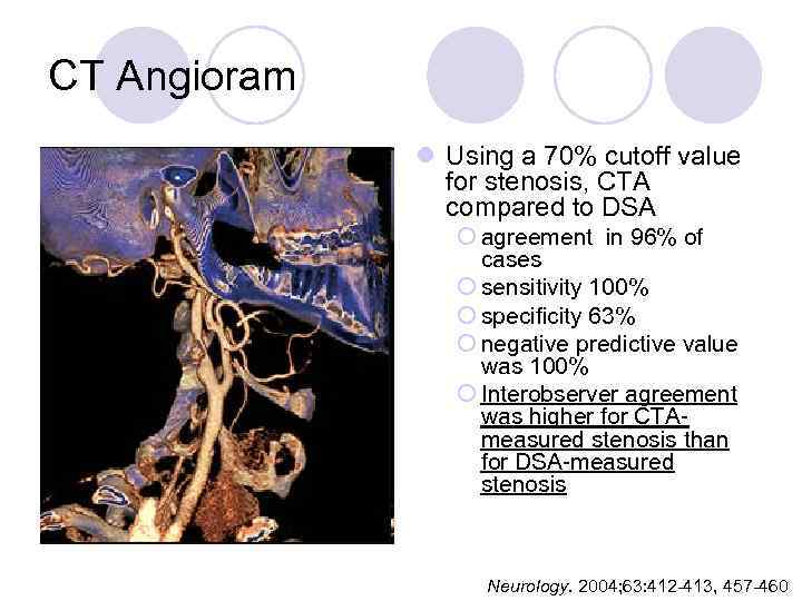 CT Angioram l Using a 70% cutoff value for stenosis, CTA compared to DSA